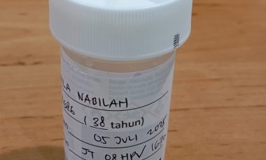 Sampel lendir serviks untuk tes DNA HPV